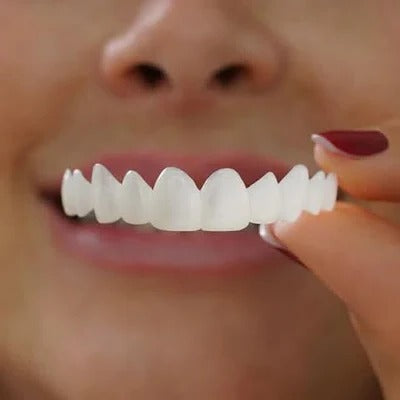 Veneers for Teeth with Natural White Finish